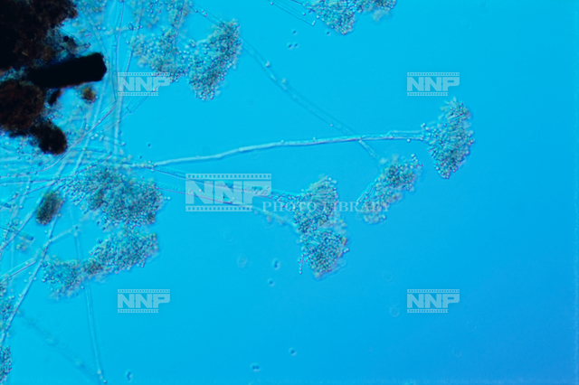 アオカビ / ≪写真素材・ストックフォト≫ NNP PHOTO LIBRARY
