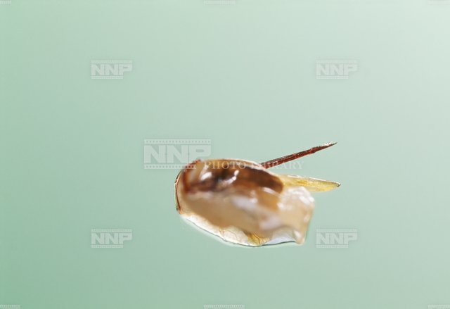 ミツバチ 毒針と毒嚢 / ≪写真素材・ストックフォト≫ NNP PHOTO LIBRARY
