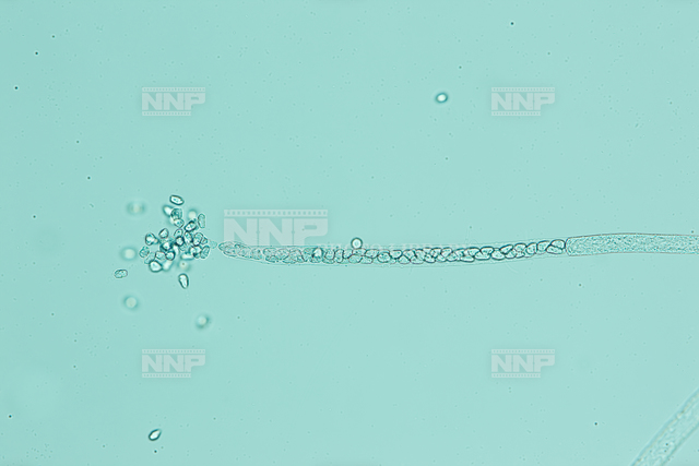 ヒメダカ No.1 に生えたミズカビ / ≪写真素材・ストックフォト≫ NNP PHOTO LIBRARY