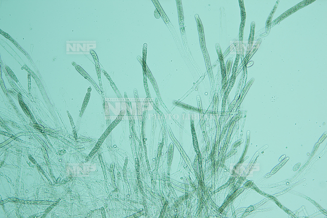 ヒメダカ No.1 に生えたミズカビ / ≪写真素材・ストックフォト≫ NNP PHOTO LIBRARY