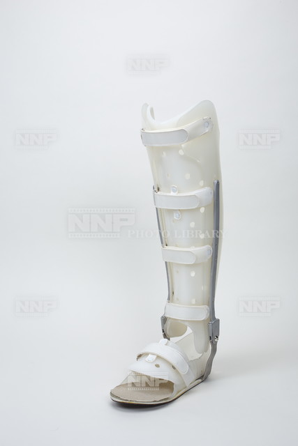 医療用ギプス 写真素材 ストックフォト Nnp Photo Library